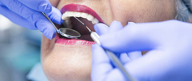 Best Emergency Root Canal Treatment in Ossian, IN